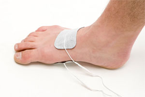 Traitement de la tendinite Achiléenne par neurostimulation TENS et courant interférentiel