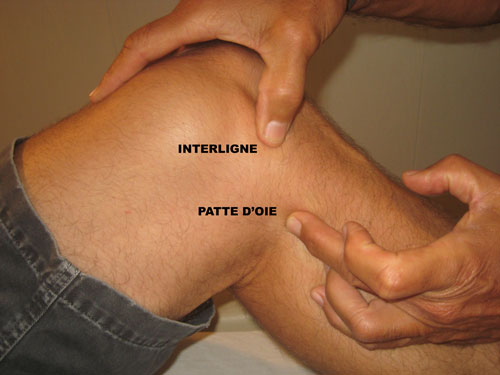 Situation de la patte d'oie
